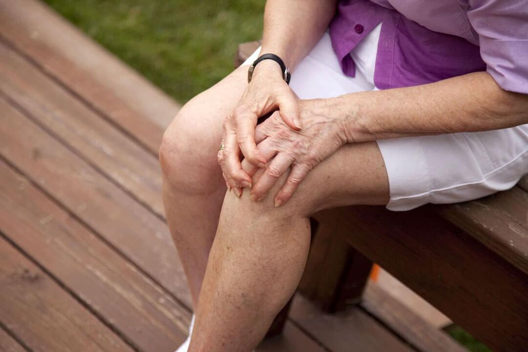 Osteoartróza kolena je bežná u starších žien