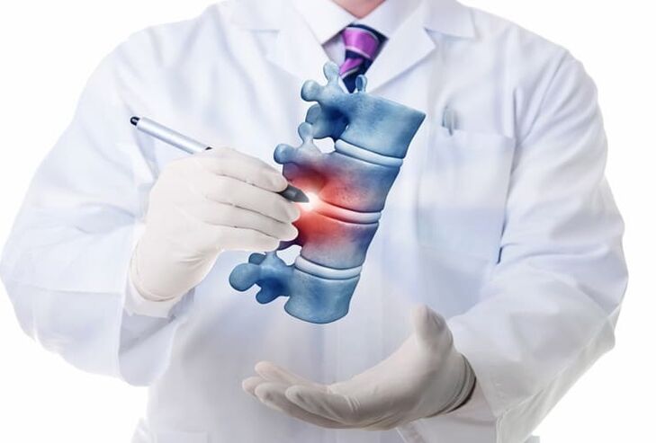 lézie chrbtice v dôsledku hrudnej osteochondrózy